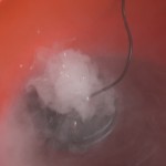 Aeroponic System Fogger